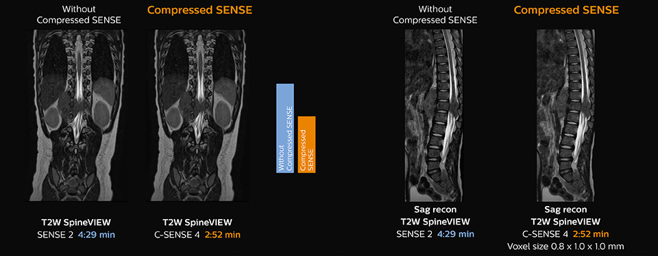 clinical image pediatric spine desktop