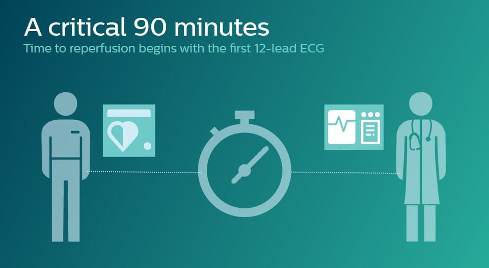 Support the 90-minute mission with tools to help clinicians implement STEMI therapy quickly