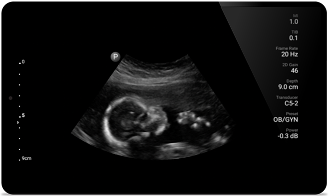 Ultrasound exam results